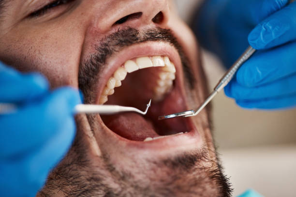 Dental Inlays and Onlays in Park Ridge, NJ